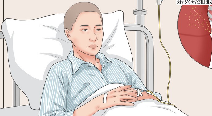 摄图网_401803185_wx_肺癌化学治疗医疗插画（企业商用）.jpg